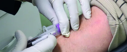 Unimed Litoral Sul realiza Campanha de Cadastro de Doadores de Medula Óssea