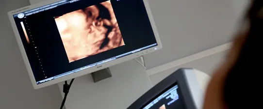 Unimed Nordeste-RS inaugura Serviço de Ecografia Gineco-obstétrica